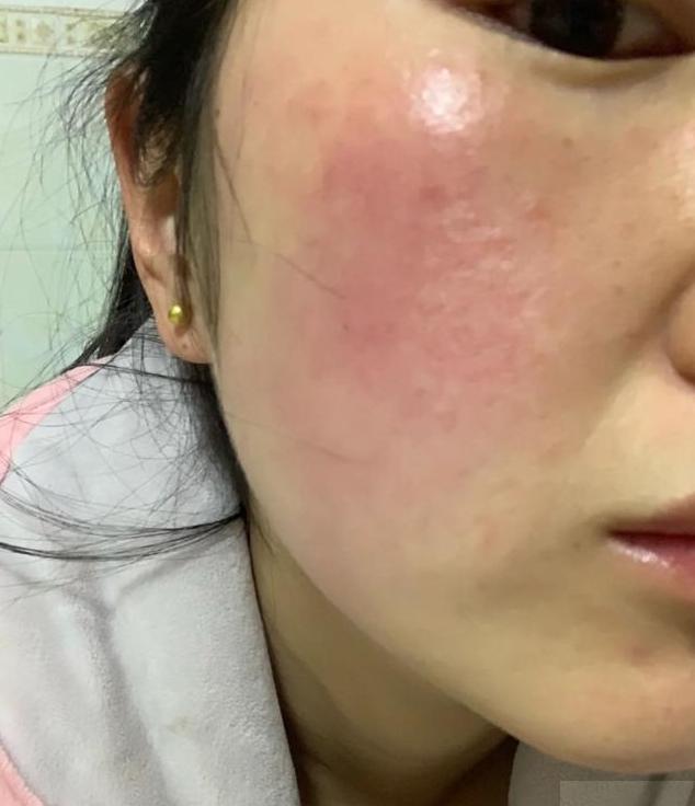 毛孔粗大有黑头适合什么粉底液,遮盖粗大毛孔黑头用什么粉底液