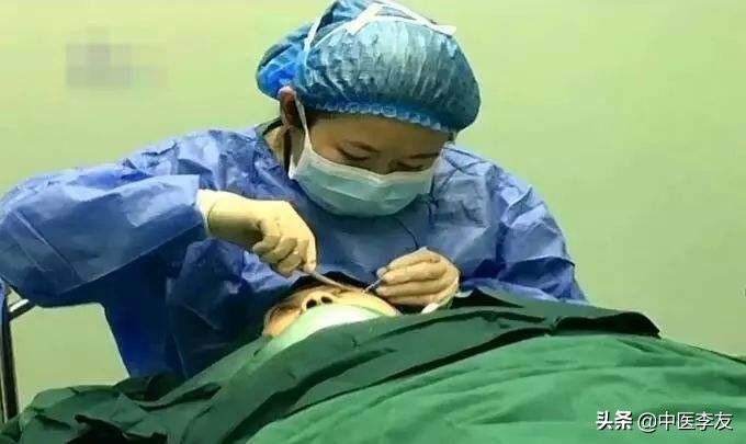 针灸学针刺的操作步骤和注意事项,学习针灸如何快速记住穴位