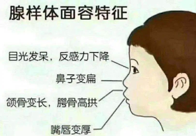 家有呼噜娃您中招了吗,家有呼噜娃别大意