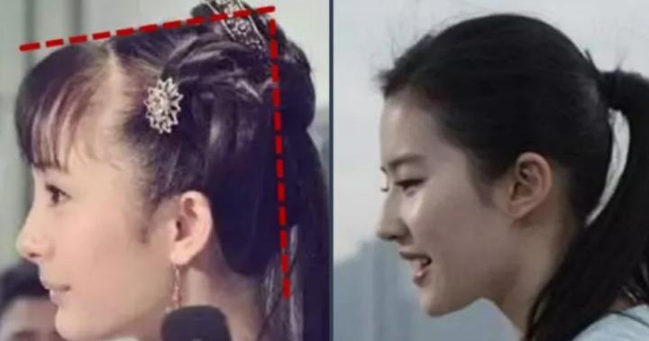 抗衰不再是简单的面部抗衰,风靡全球面部抗衰的最好方法