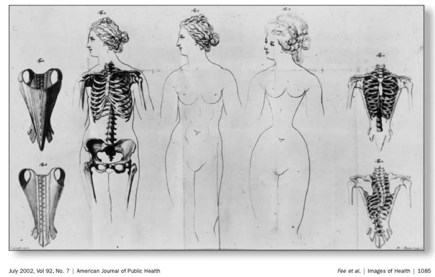 网红束腰打假,女网红束腰