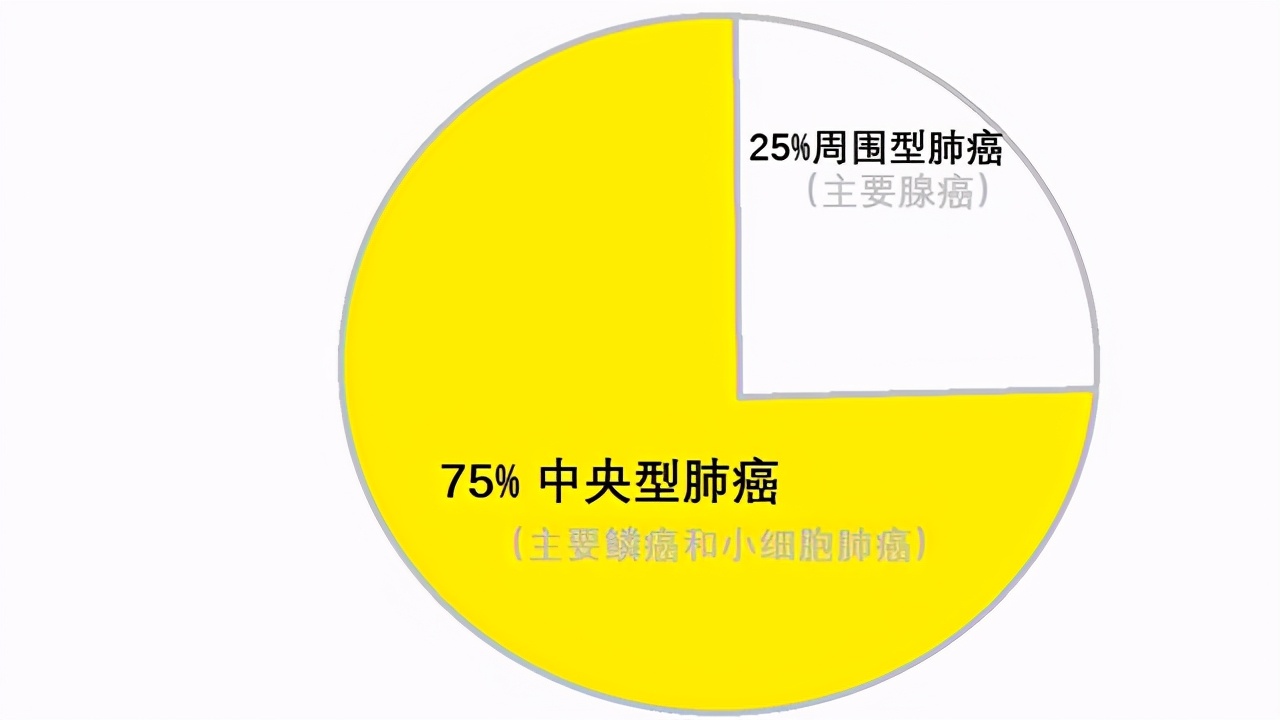 小细胞肺癌骨转移化疗有意义吗,小细胞肺癌化疗后多发骨转移