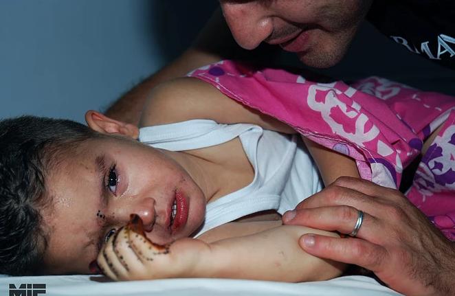 初到人间的宝宝,男宝包皮过长什么时候治疗