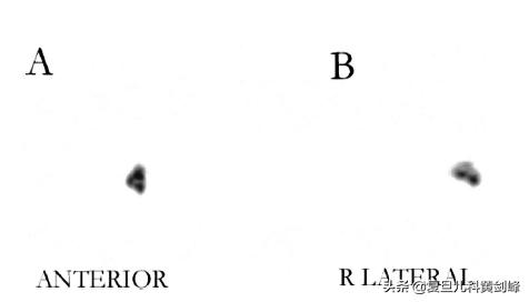 洗鼻子正确方式,孩子洗鼻子的正确方法视频