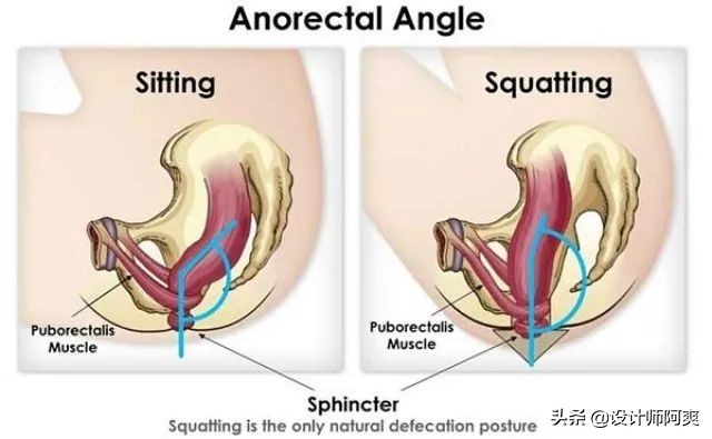 马桶和蹲厕哪个好,蹲厕好还是坐便器好