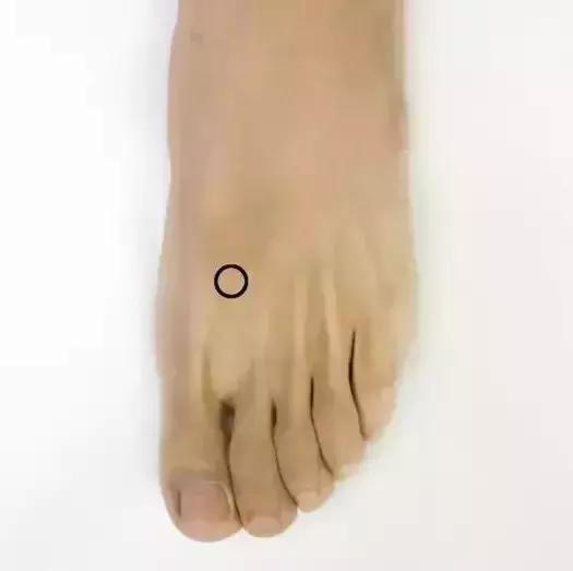 胡希恕经方治疗乳腺增生,中医治疗乳腺增生的处方