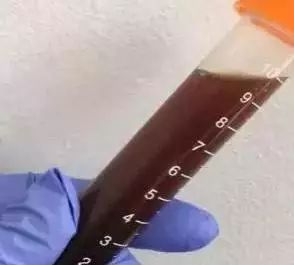 初中生体育马步深蹲,体育课100个抱头深蹲