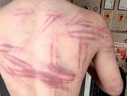 瞒不住了？！疫情最大的黑洞，这个国家可能导致疫情爆发