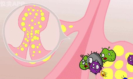 痘印痘坑真正祛除的方法,痘印痘坑去不掉怎么办