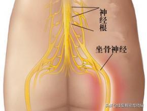 四个动作缓解坐骨疼痛,一个动作缓解坐骨神经痛