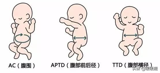 双顶径头围腹围对照表胎儿体重,如何判断胎儿股骨长短