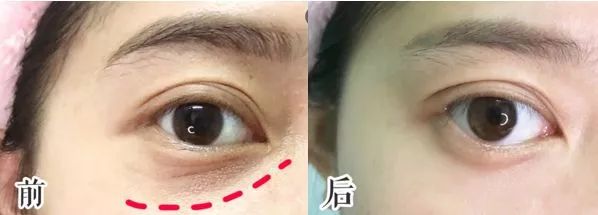 何洁越来越年轻,何洁穿衣又换新造型