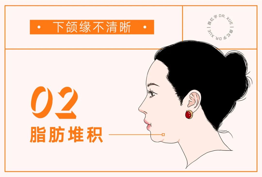 让下颚越来越清晰,下颌缘不清晰的原因