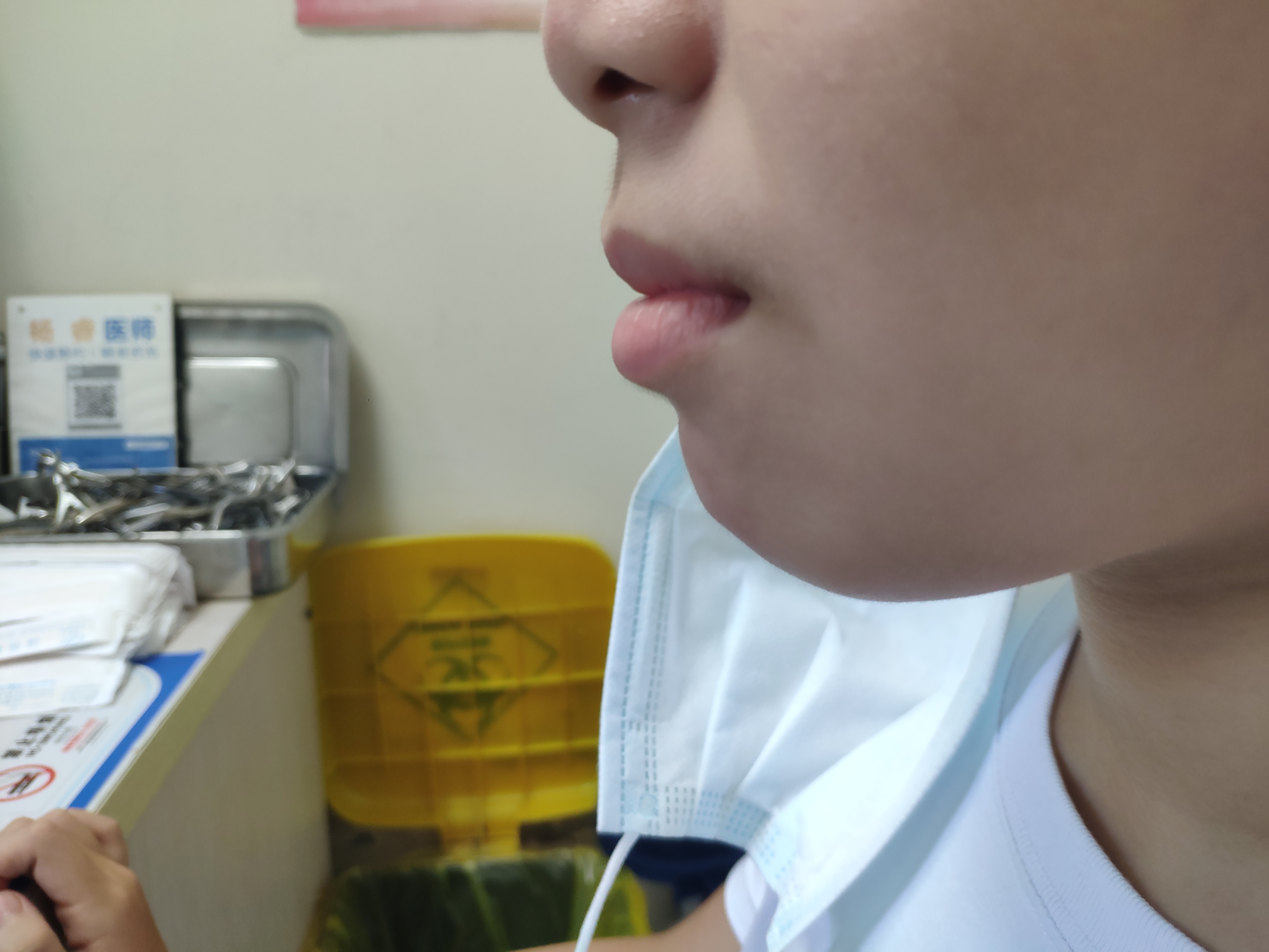 4岁儿子脾气暴躁，安静不了，是腺样体肥大还是多动症，要手术吗