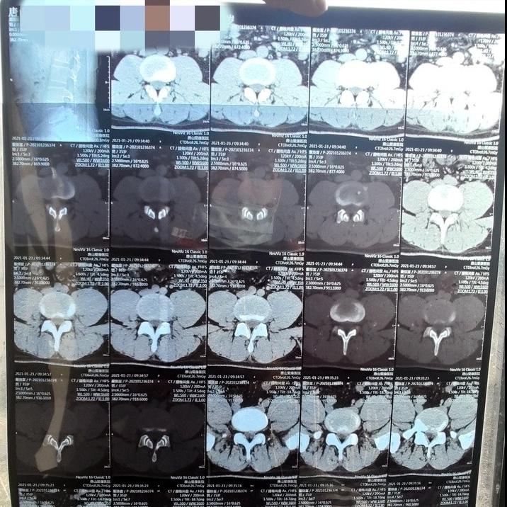 我与病魔抗争的日子,我和癌症抗争的那些年