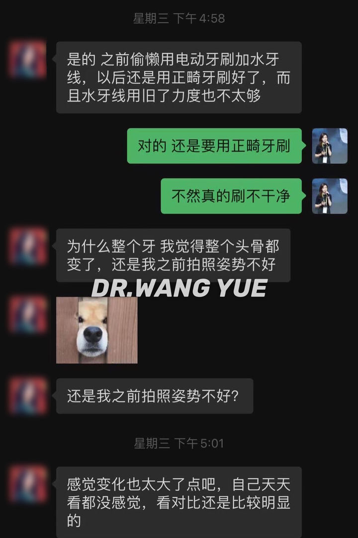 上海口腔医院牙齿矫正牙缝,上海牙齿畸形龅牙矫正