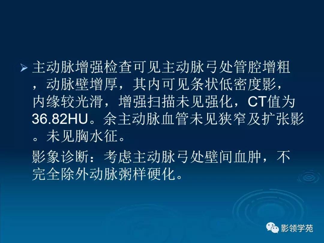 主动脉壁间血肿护理查房,主动脉夹层和壁间血肿图片