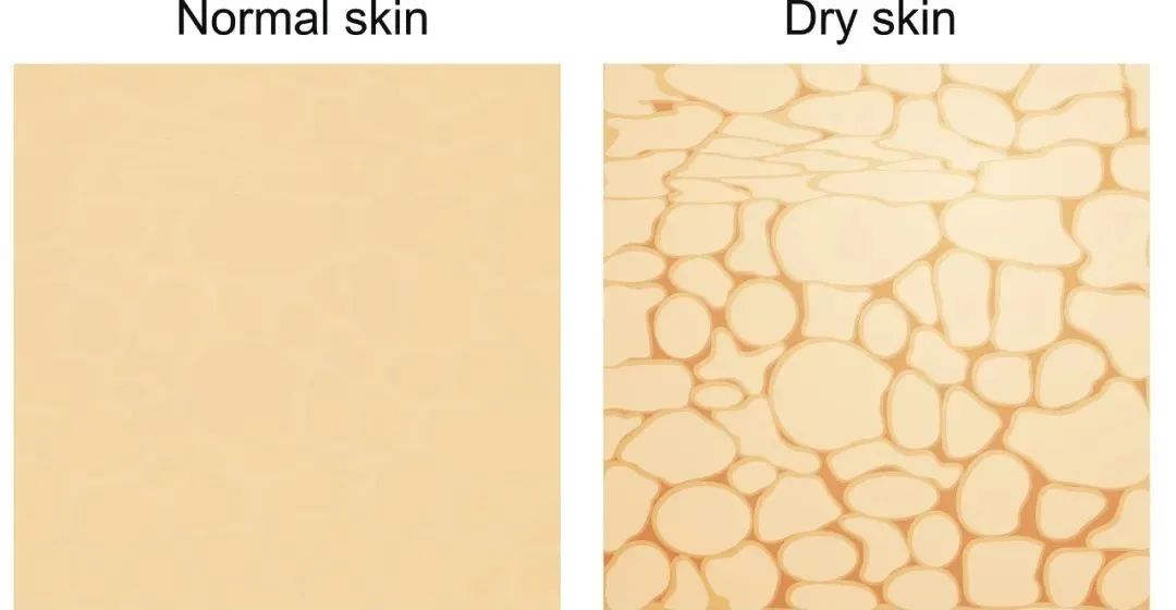 抬头纹法令纹可以用护肤品消除吗,抬头纹法令纹鱼尾纹克星能管用吗