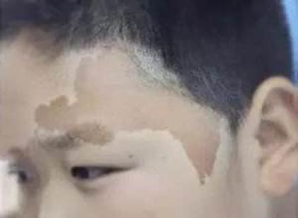 痣出现的位置真的重要吗,痣相大揭秘来看看吧