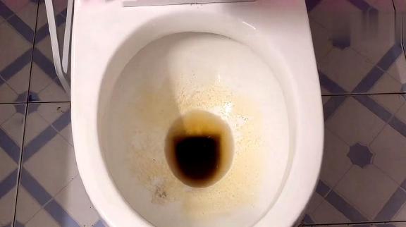 马桶顽固垢能用火烧吗,马桶陈年硬垢堵厕所