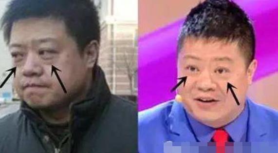 戚薇推荐的40款眼霜,戚薇推荐的15款眼霜