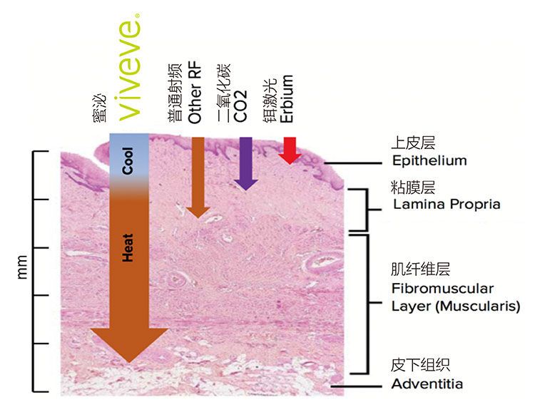 产后的你有没有漏尿的情况,产后漏尿又紧致最快恢复办法