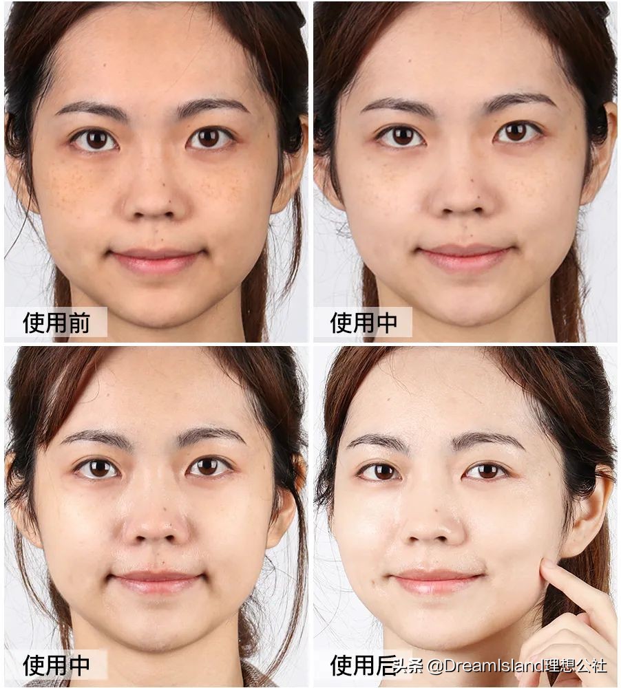 50岁冻龄妈妈有做医美吗,冻龄阿姨保养秘诀