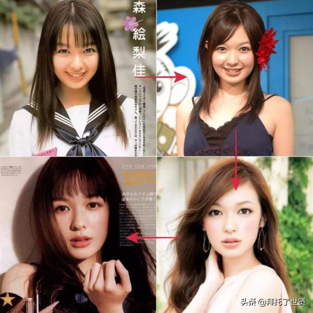石原里美和佐藤健,石原里美整容之路