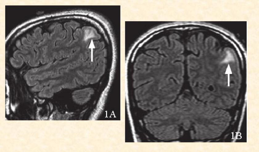 医生说怀孕了有没有可能错了,医生说怀孕有风险