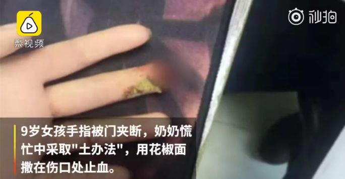 花椒面止血，活蝌蚪下火，开水止抽搐……父母不用考试，细思恐极啊
