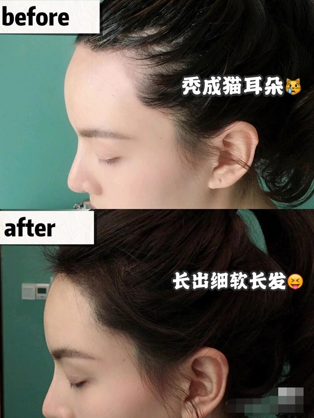 戚薇袁咏仪推荐的洗发水,袁咏仪推荐好用洗发水