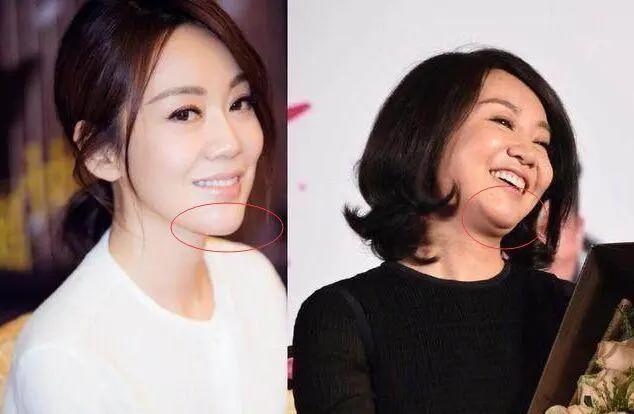 减肥没有到达3个月，就没有真正进入稳固期，别刚开始就喊:没效果