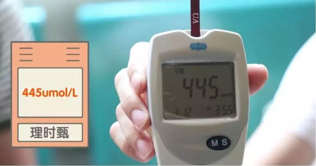 痛风检测仪器有用吗,痛风患者如何选购尿酸测试仪器