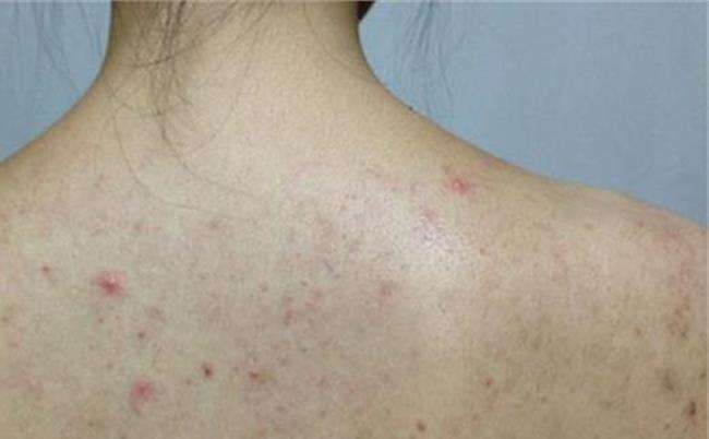 日本发明了洗澡按摩器,日本变态护颈神器