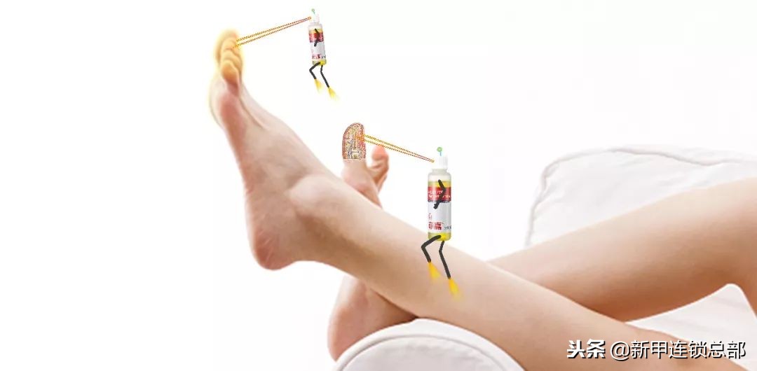 因为灰指甲，被儿媳嫌弃，不让带孙子，幼儿园被退学！新甲连锁