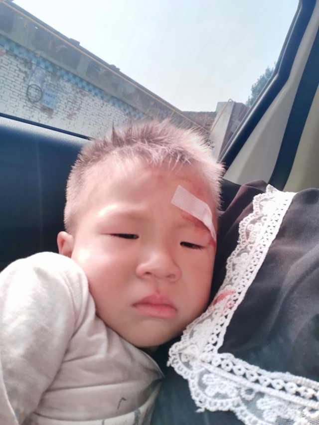 记录一个自责的妈妈，宝宝摔倒缝针，保佑不要留疤