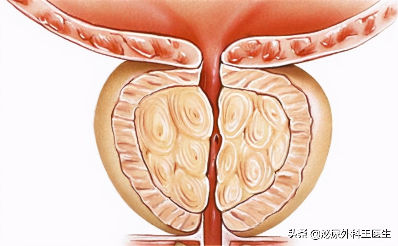 坦索罗辛只能治疗男性吗,坦索罗辛尿频改善时间
