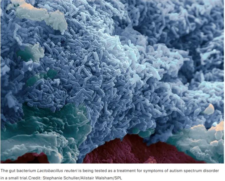 肠道如何让大脑更健康的,肠道控制大脑的方法