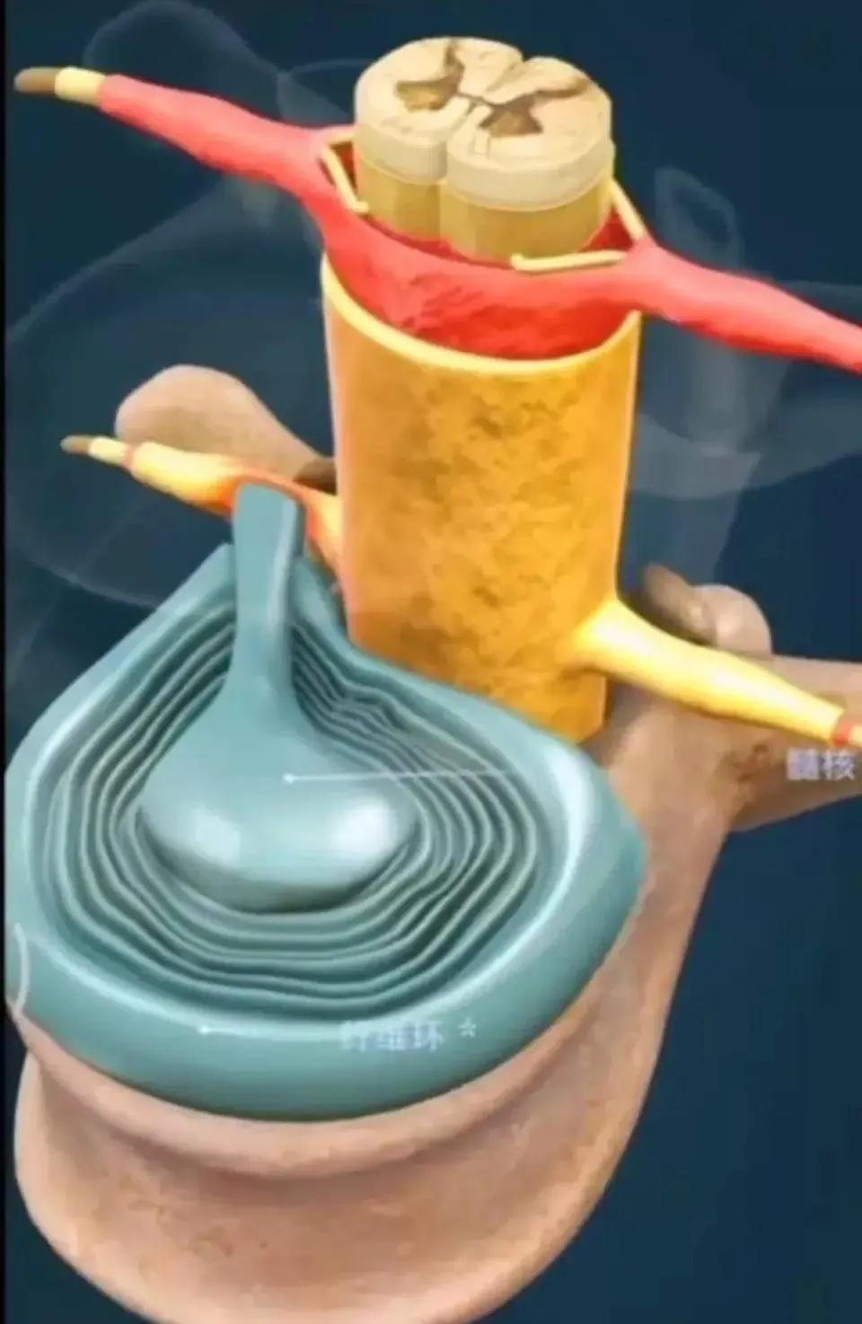 腰痛的最快治疗方法做什么检查,腰痛鉴别诊断标准是啥