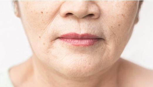 抬头纹鱼尾纹法令纹哪个更显老,抬头纹鱼尾纹法令纹颈纹一样没少