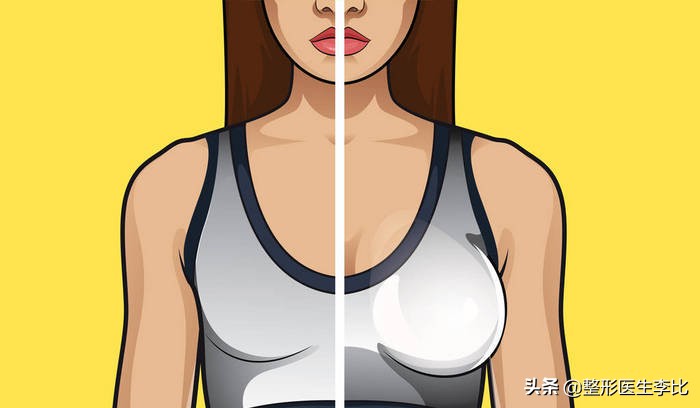 自体脂肪和假体隆胸哪个更安全,自体脂肪隆胸假体隆胸哪个恢复快