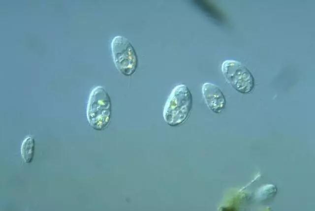 收藏!24种污水处理微生物菌相及指导意义,环保人必看(多图)