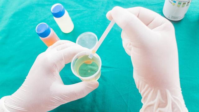 儿童肾病会发展尿毒症,9岁小孩得肾病好治吗