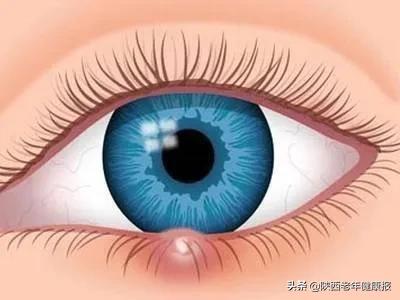 宝宝视力检查异常是什么意思,宝宝眼睛的异常现象