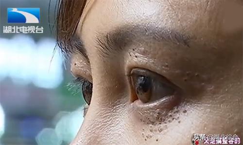 花4万元做了鼻整形不满意怎么办,女子花了2万整形鼻子保不住