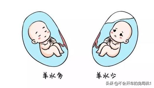 怀孕期间喝水少羊水会很少呢,37周羊水少喝水还能补上来吗