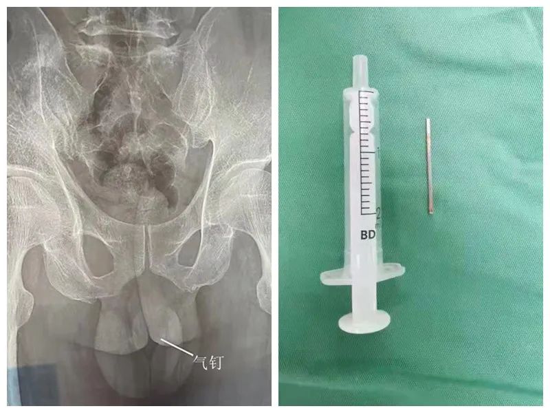 疫情期间门诊危急重症病人处置,疫情紧急救援视频惊心动魄