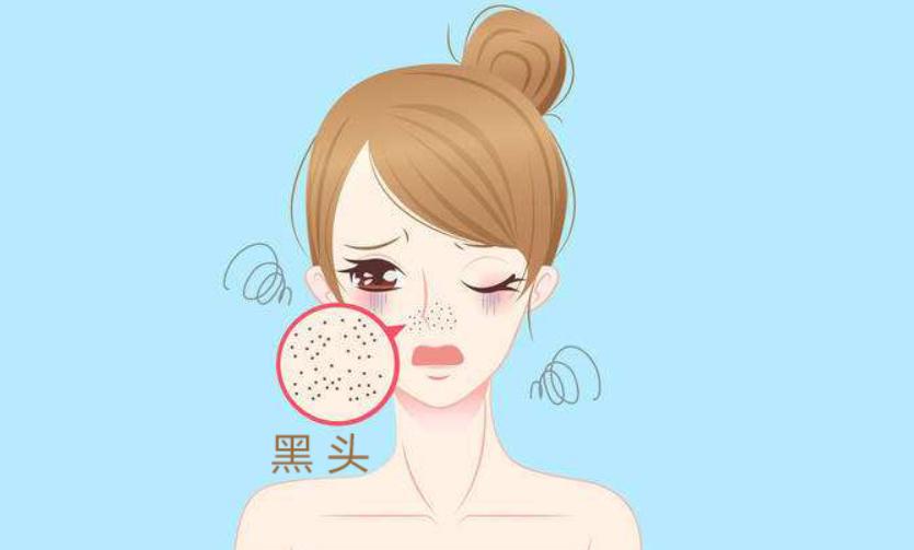 去黑头为什么黑头越来越多,长了黑头到底能不能挤