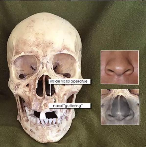 法医根据头骨还原死者,颅骨还原画像原理