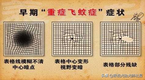 飞蚊症的相关知识,飞蚊症科普短视频